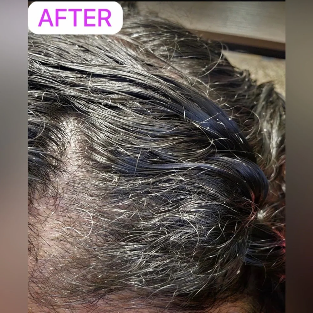 Nizoral Anti-Dandruff Shampoo - Picture 3 of 4